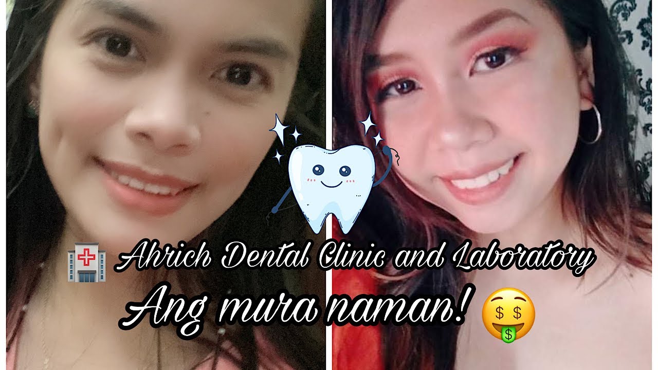 Ang murang dental clinic! 200 lang?! YouTube