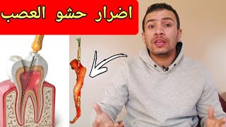 ماذا يعني حشو العصب للضرس و ما تأثيره الحقيقي الذي لا يذكره الاطباء