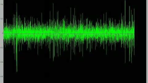 Automated seizure detection