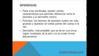 ¿Dermatitis o psoriasis? ¿Cual es la diferencia?