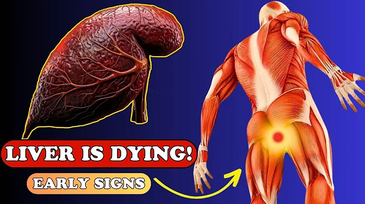 LIVER is DYING! 12 Weird Signs of LIVER DAMAGE | Health care - DayDayNews