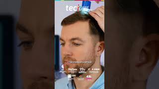PRP в Эстетической Дерматологии: Клеточная Регенерация и Лечение Волос
