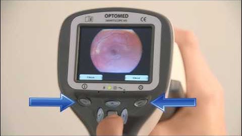 Smartscope PRO with EY4 - Image preview and zooming