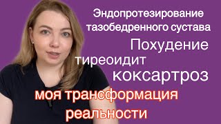 История похудения, история болезни, новый образ жизни