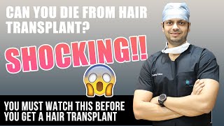 Death After Hair Transplant | Fact Check | Medlinks Hair Transplant -  YouTube