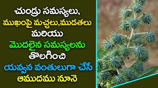 చుండ్రు సమస్యలు ,ముఖంపై మచ్చలు ,ముడతలు తొలగించి యవ్వనం గా చేసే ఆముదము నూనె   |vasavi tv||amudam nune