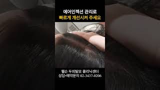 때 이른  장마 두피질환 경보#두피관리 #두피스케일링 #탈모관리 #샴푸추천 #지루성두피염 #지루성두피샴푸 #장마 #장마대비