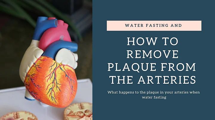 THE #1 WAY TO REMOVE PLAQUE FROM THE ARTERIES