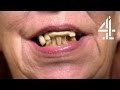 Woman With No Teeth Hides It with Chewing Gum | Never Seen A Doctor
