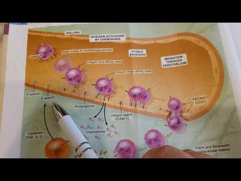 Video: Breekbaar Othelium Chastiform