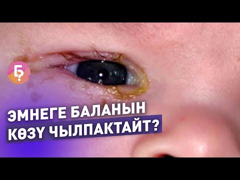 Video: Педиатр эмнени билиши керек, эмнени жасай билиши керек?