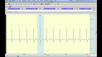 AcqKnowledge Waterfall Plot