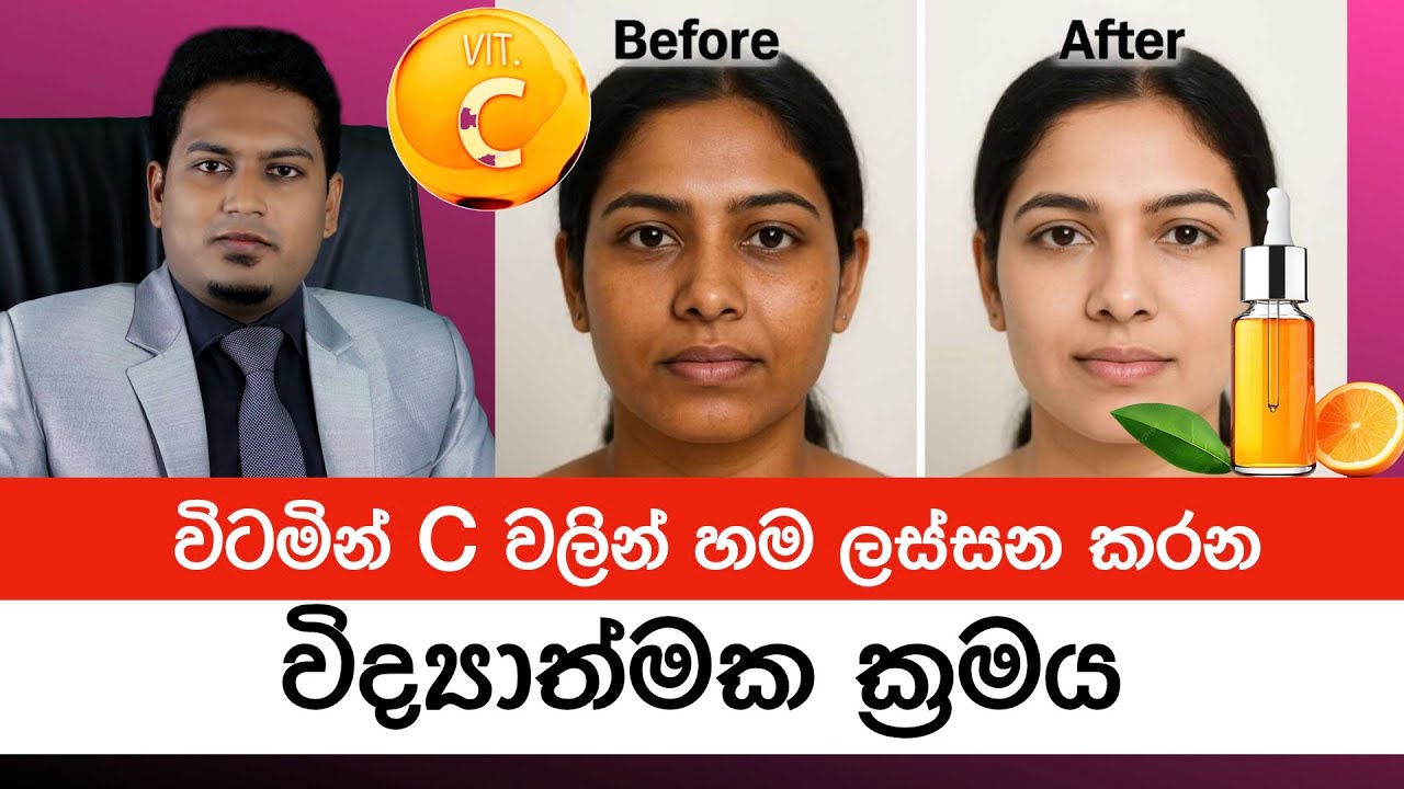සම ලස්සන කරන විටමින් C පාවිච්චි කරන   විද්‍යාත්මක ක්‍රමය|  Vitamin C for Skin By Nutri Info