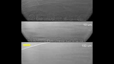 Microbubble dynamics and heat transfer in boiling droplets