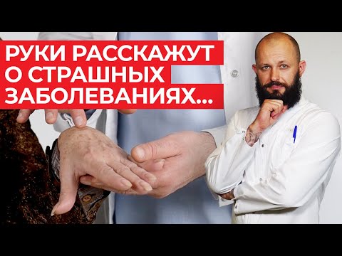 О каких проблемах говорят наши руки? / Как узнать по рукам, чем болен человек?