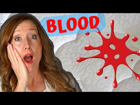 How to Get Blood Stains out of a Mattress