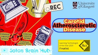 Carotid Atherosclerotic Disease
