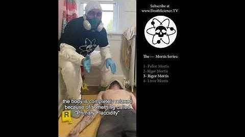 Stages of Death: Pallor, Algor, Rigor, Livor