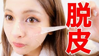 【韓国】リアルスキンパッチでニキビケア【ゆきぽよ】