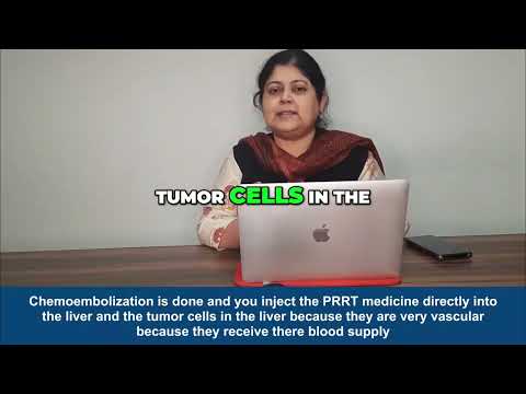 Intra-Arterial PRRT for Liver Metastases