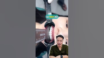 Mỗi chiếc răng đều định hình lên nụ cười của bạn #drthu #bsthu