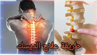 طريقة علاج اسفل الظهر (الديسك )