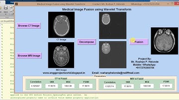 Image Fusion using Wavelet Transform matlab project source code