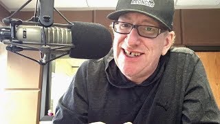 Update Jaw Surgery Recovery 6 Weeks Post Sarpe