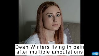 Dean Winters living in pain after multiple amputations Wealth