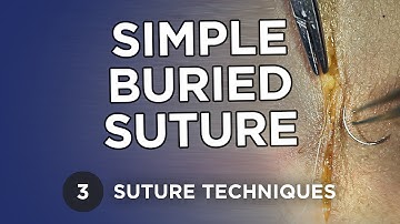 Simple Buried Suture - Learn Suture Techniques