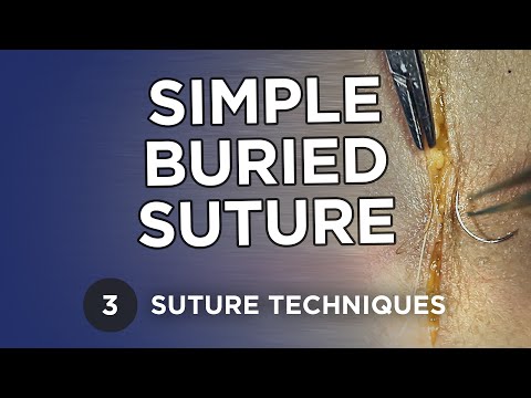 Simple Buried Suture - Learn Suture Techniques