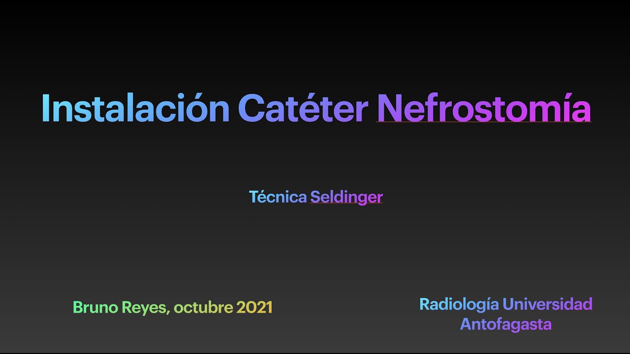 Instalación Catéter Nefrostomía Técnica Seldinger - YouTube