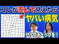 【黄斑前膜】視力0.4から1.2へ戻った実例も！手術すべきかしないべきか？それが問題だ！