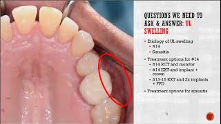 (Dentistry) Comprehensive Treatment Planning - Dr. Denny Chao, DMD