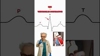 EKG Basics
