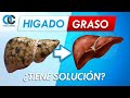 Hígado graso ¿lo sabías?