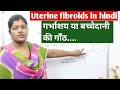 Uterine fibroids  fibroids uterus       definition  types  ranjana rock nursing