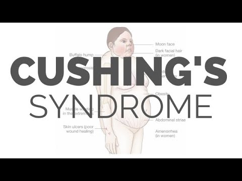 What is Cushing Syndrome - pathology, symptoms, causes, diagnosis, treatment