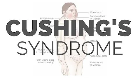 What is Cushing Syndrome - pathology, symptoms, ca...