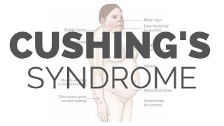 What is Cushing Syndrome - pathology, symptoms, causes, diagnosis, treatment