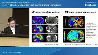 Мультимодальная оценка стеатозных заболеваний печени. Венедиктова Д.Ю