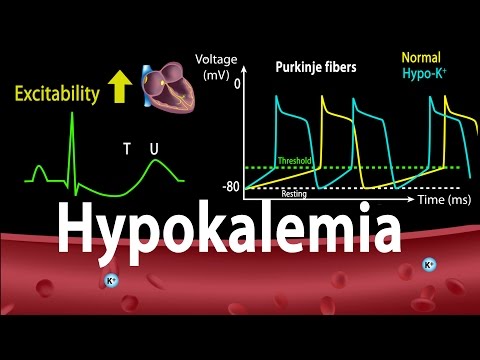 hypokalemia:-causes,-symptoms,-effects-on-the-heart,-pathophysiology,-animation.