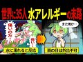 【実話】水アレルギーになってしまったずんだもんの末路【ずんだもん&ゆっくり解説】