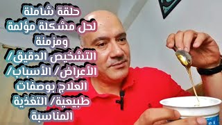 التخلص من القاولون العصبي والكبد الدهني بمكونات طبيعية بسيطة