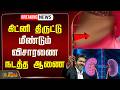 🔴LIVE: கிட்னி திருட்டு.. மீண்டும் விசாரணை நடத்த ஆணை | Kidney Theft Case Update