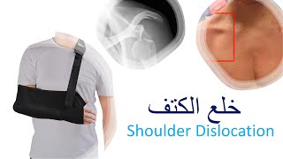 Shoulder dislocation / خلع مفصل الكتف
