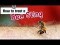 Bee Sting Pain Getting Worse This Changes Everything Bee Sting Pain Getting Worse This Changes Everything