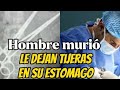 Murió Luego que Cirujano Dejara unas Tijeras en su Estómago.