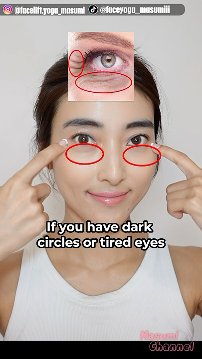 Try This Massage for Eye Bags, Dark Circles Under Eyes #shorts #eyebags