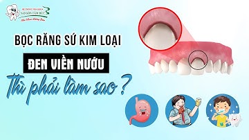 BỌC RĂNG SỨ KIM LOẠI BỊ ĐEN VIỀN NỨU THÌ PHẢI LÀM SAO?